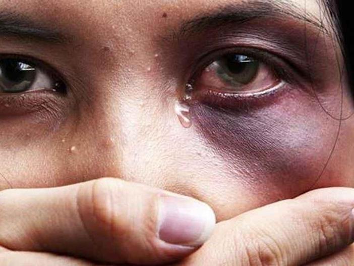 “Você vai ficar careca e vou lhe mostrar que você não fica comigo e nem com ninguém”: mulher relata socos no rosto, mordidas e tentativa de arrancar dedo pelo companheiro em Conceição do Coité
