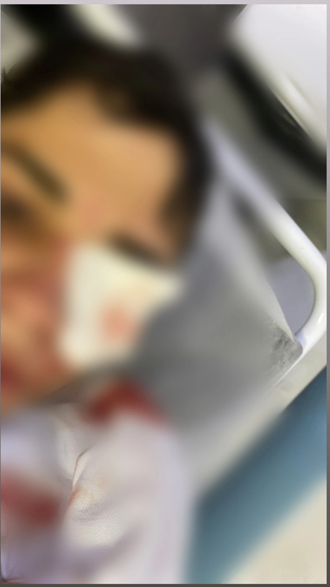 Jovem fica ferido após ser atacado com uma lata de cerveja no rosto durante confusão na madrugada desta segunda-feira (04)