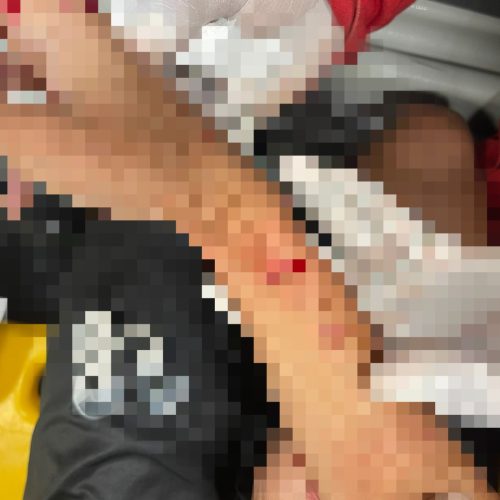 Jovem se fere ao socar espelho no bairro Pampulha em Conceição do Coité