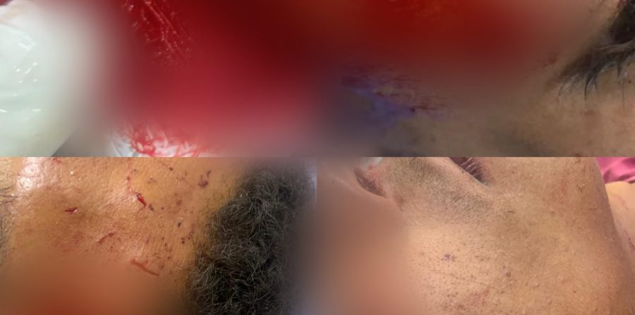 Jovem é atingido por garrafada e sofre cortes no rosto no bairro da Mansão em Conceição do Coité