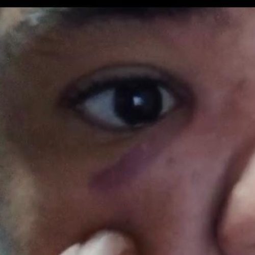 Família de jovem com deficiência intelectual contesta versão de homem que acionou PM no distrito de Bandiaçu em Conceição do Coité. Entenda!