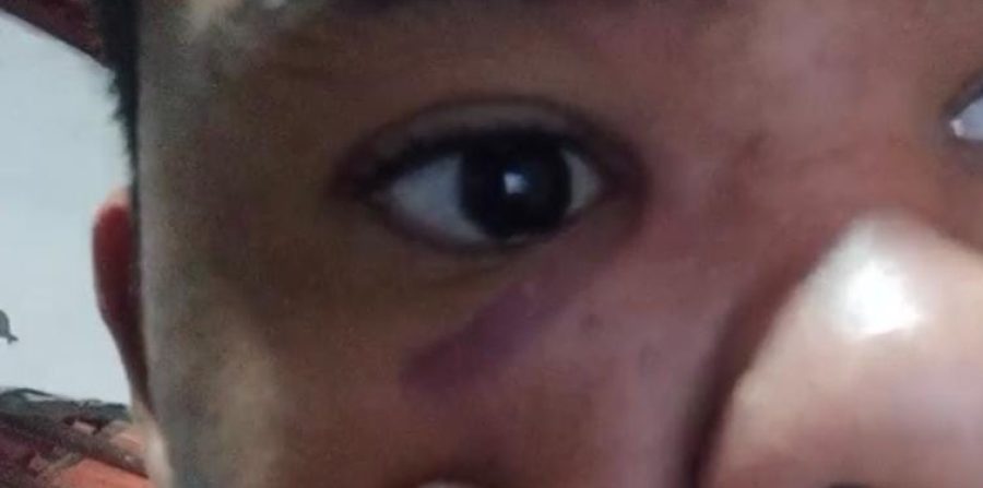 Família de jovem com deficiência intelectual contesta versão de homem que acionou PM no distrito de Bandiaçu em Conceição do Coité. Entenda!