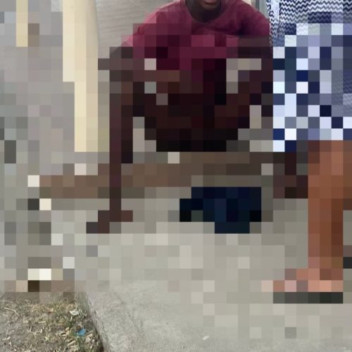 Adolescente é mordido no pênis por pitbull ao tentar pular muro em Santaluz