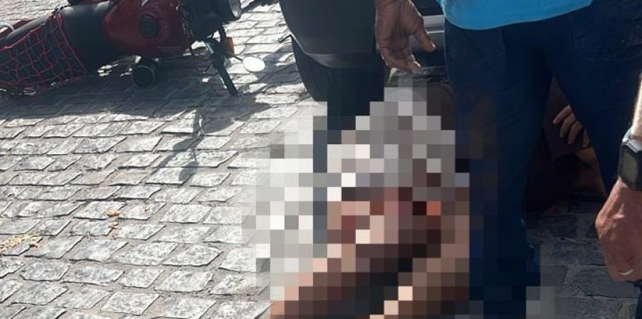 Jovem passa por cirurgia com enxerto após grave acidente em Conceição do Coité; ela segue internada em Feira de Santana sem previsão de alta