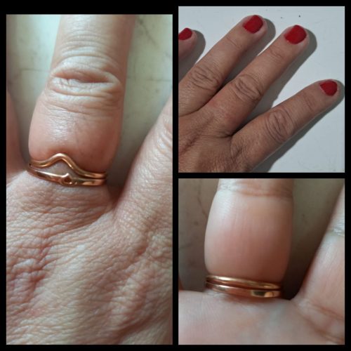 Mulher procura Águia Resgate após anéis ficarem presos nos dedos em Conceição do Coité