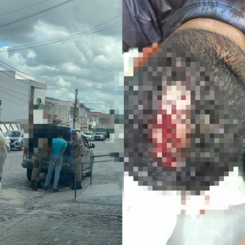 URGENTE: Socorrista do Águia Resgate é ferido com golpe de facão na cabeça no centro de Conceição do Coité; autor é suspeito de assediar filha da vítima