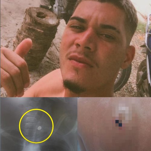 “Se eu estivesse com droga ou armado, eles deveriam ter ido atrás de mim para verificar a situação, mas não foram”, diz jovem atingido por tiro nas costas pela PRE em Conceição do Coité