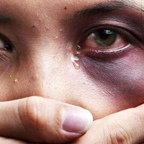“Você vai ficar careca e vou lhe mostrar que você não fica comigo e nem com ninguém”: mulher relata socos no rosto, mordidas e tentativa de arrancar dedo pelo companheiro em Conceição do Coité