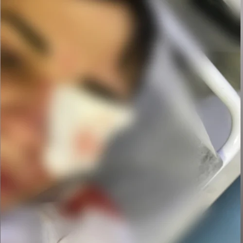 Jovem fica ferido após ser atacado com uma lata de cerveja no rosto durante confusão na madrugada desta segunda-feira (04)