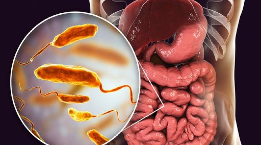 un-remede-miracle-pour-guerir-du-cholera-vous-ne-devinerez-jamais-d-ou-il-provient-1726866908386_512